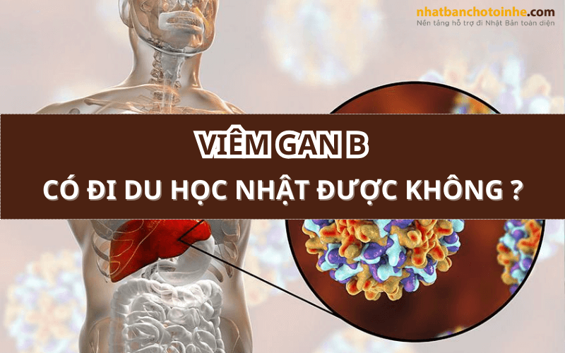 Người Bị Viêm Gan B Có Đi Du Học Nhật Được Không?